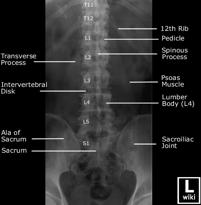 Lumbar Spine Radiographic Anatomy 네이버 블로그