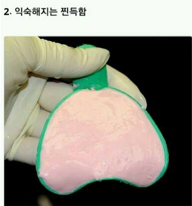 치아교정의 고통 ㄷㄷㄷ.jpg | 인스티즈